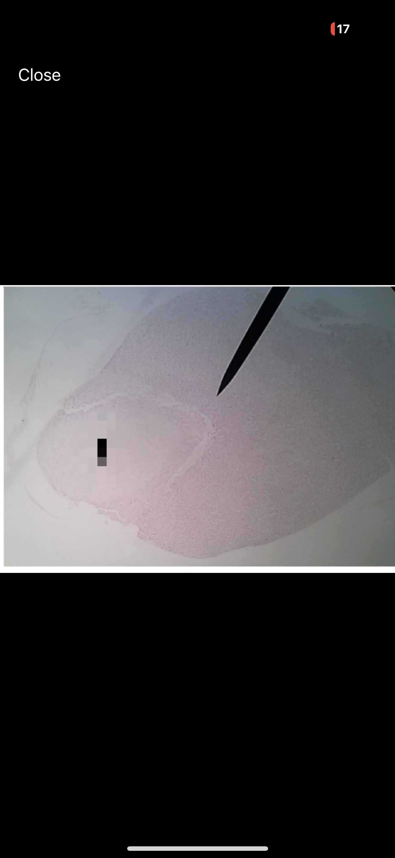 <p>What hormone is associated with large pink area?</p>