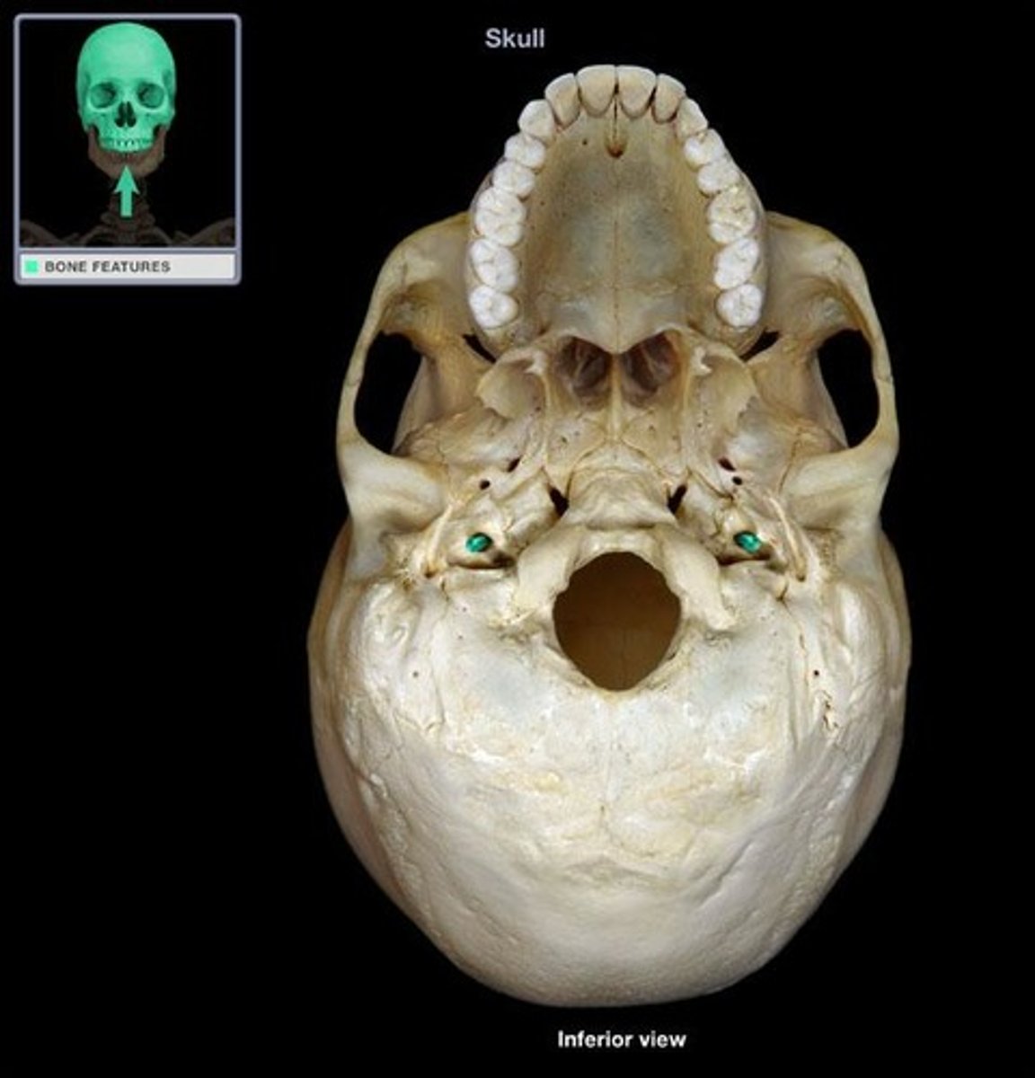 <p>located on petrous part of the temporal bone anterior to the jugular foramen</p>