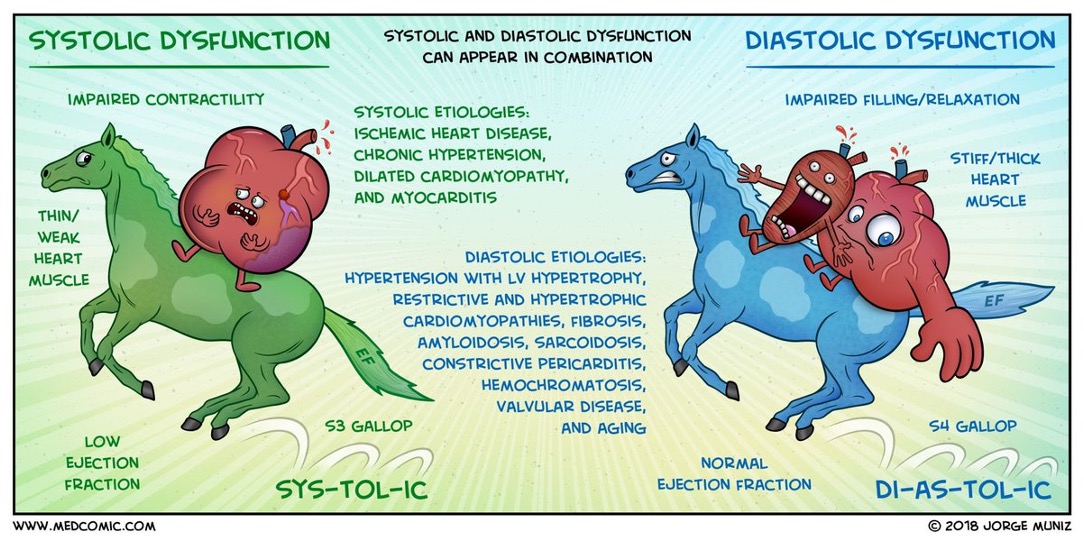 <p>Systolic vs Diastolic Dysfunction Summary</p>