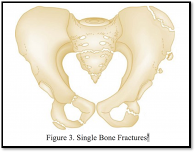 <p><strong><span>Pelvic Fracture </span>( Def. / S&amp;S / Comp. / Diagnostic / Tx / Nursing)</strong></p>