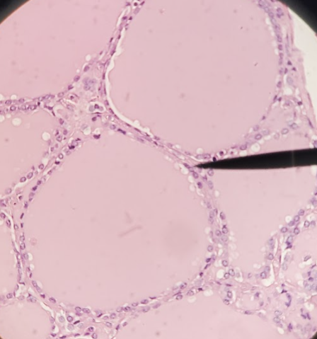 <p>_____ _____ of the thyroid is responsible for the production of T3 &amp; T4</p><ul><li><p>_____ is the pink colloid and precursor of T3/T4</p></li></ul><p></p>