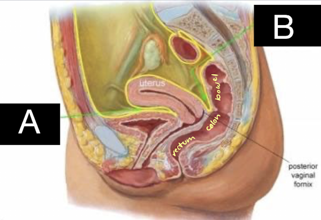 <p>what is A pointing to?</p>