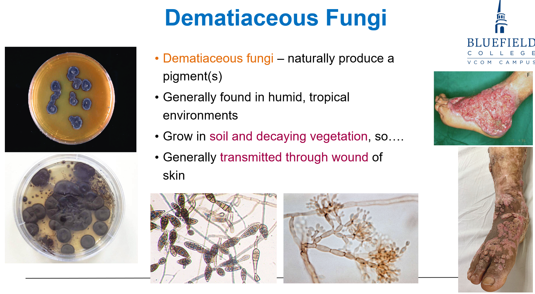<p><strong>Through wounds in the skin</strong> after contact with contaminated soil or plant material.</p>