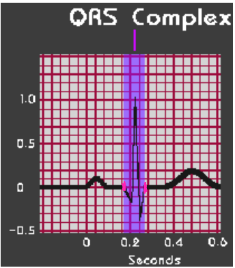 <p><strong>QRS Complex</strong></p><p>-Represents ___________ depolarization</p><p>-Normal value is &lt; .__ seconds</p><p>-Measure from start of Q wave to the end of S wave (aka J point)</p>