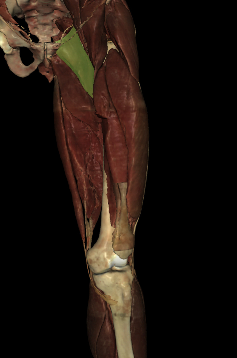 <p>Identify the Structure</p>