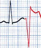 <p>What rhythm is this called?</p>