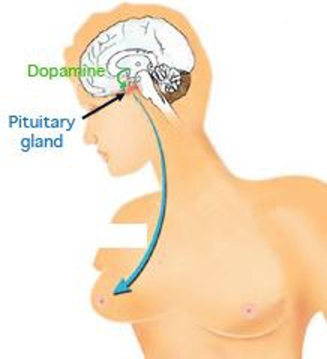 <p>a hormone secreted by the anterior pituitary. It stimulates milk production.</p>