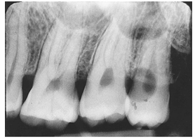 <p>What is the problem with this DEVELOPER SPOTS X-ray? </p>