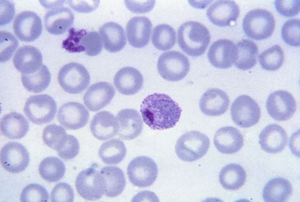 <p>Which protist is this?</p>