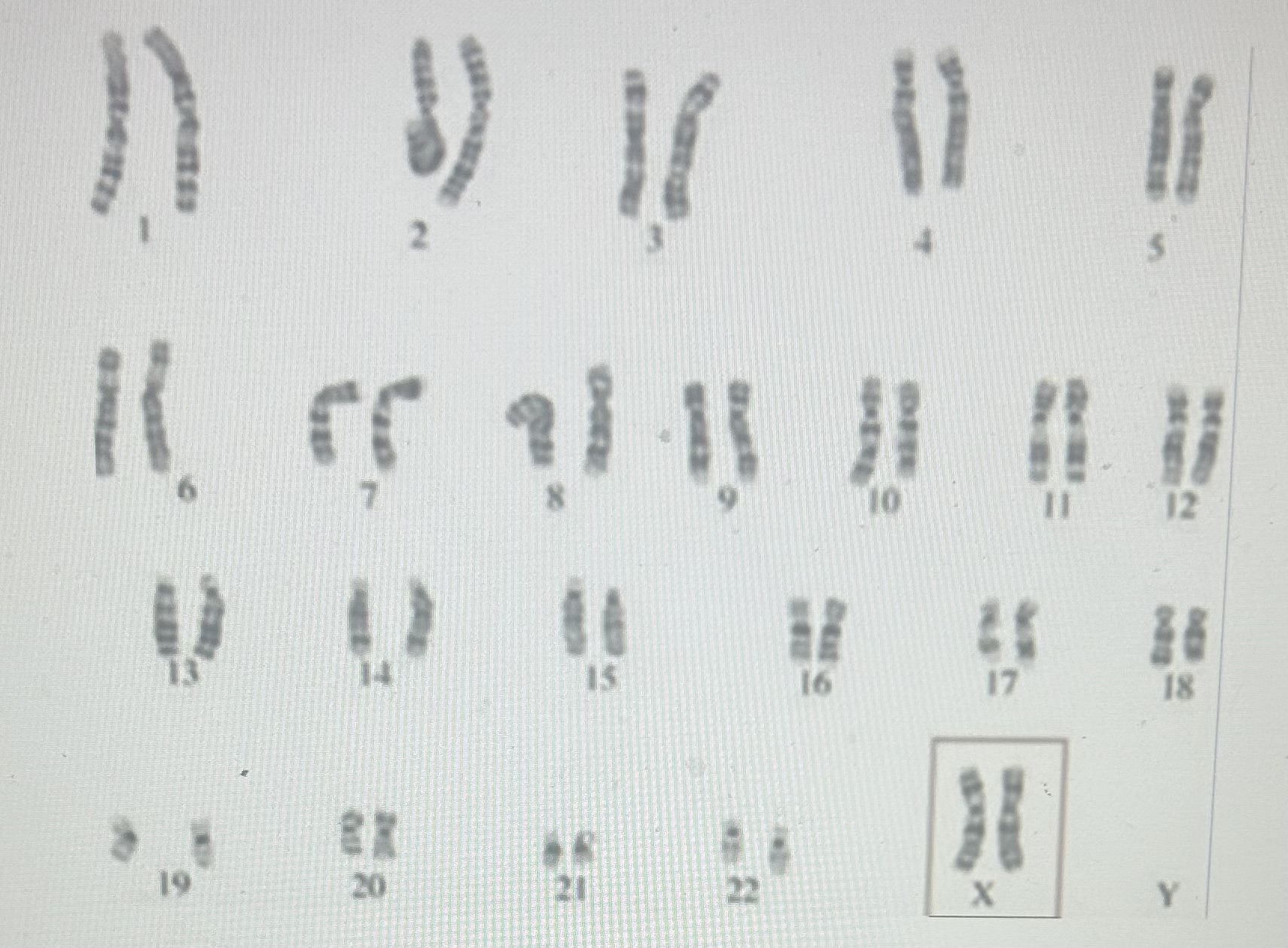 Using the information in this image, does the set of chromosomes indicate that individual has testes or ovaries? Why is this so? 