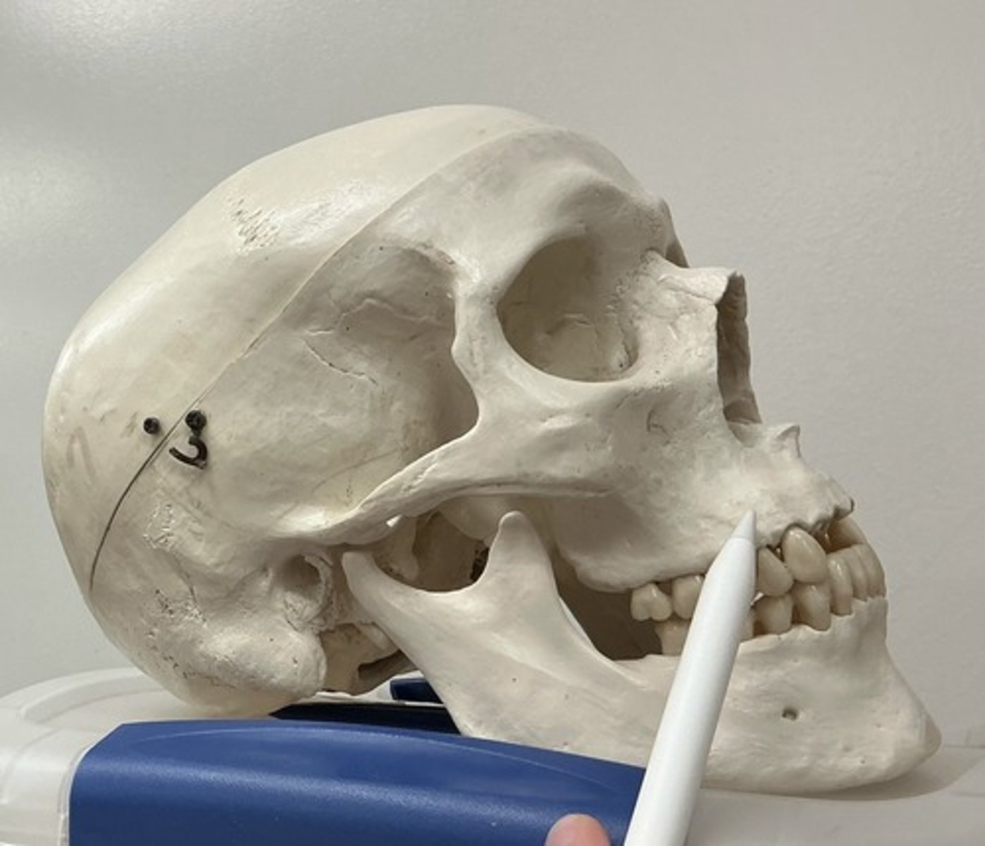 <p>What bone is this?</p>