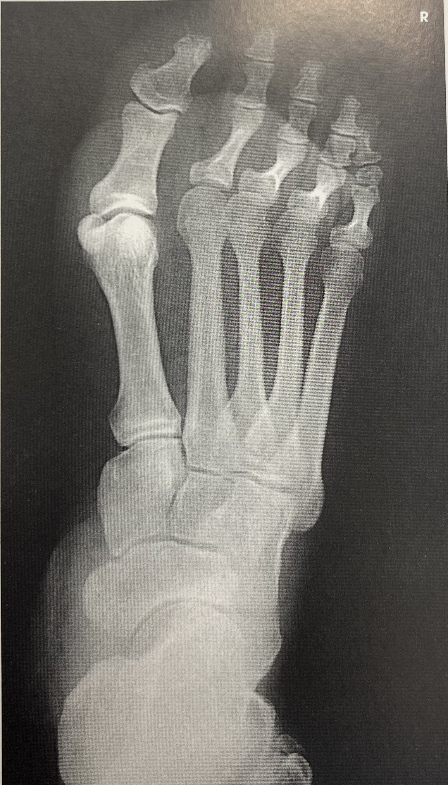 <p>identify part <strong>position</strong> of the image </p>