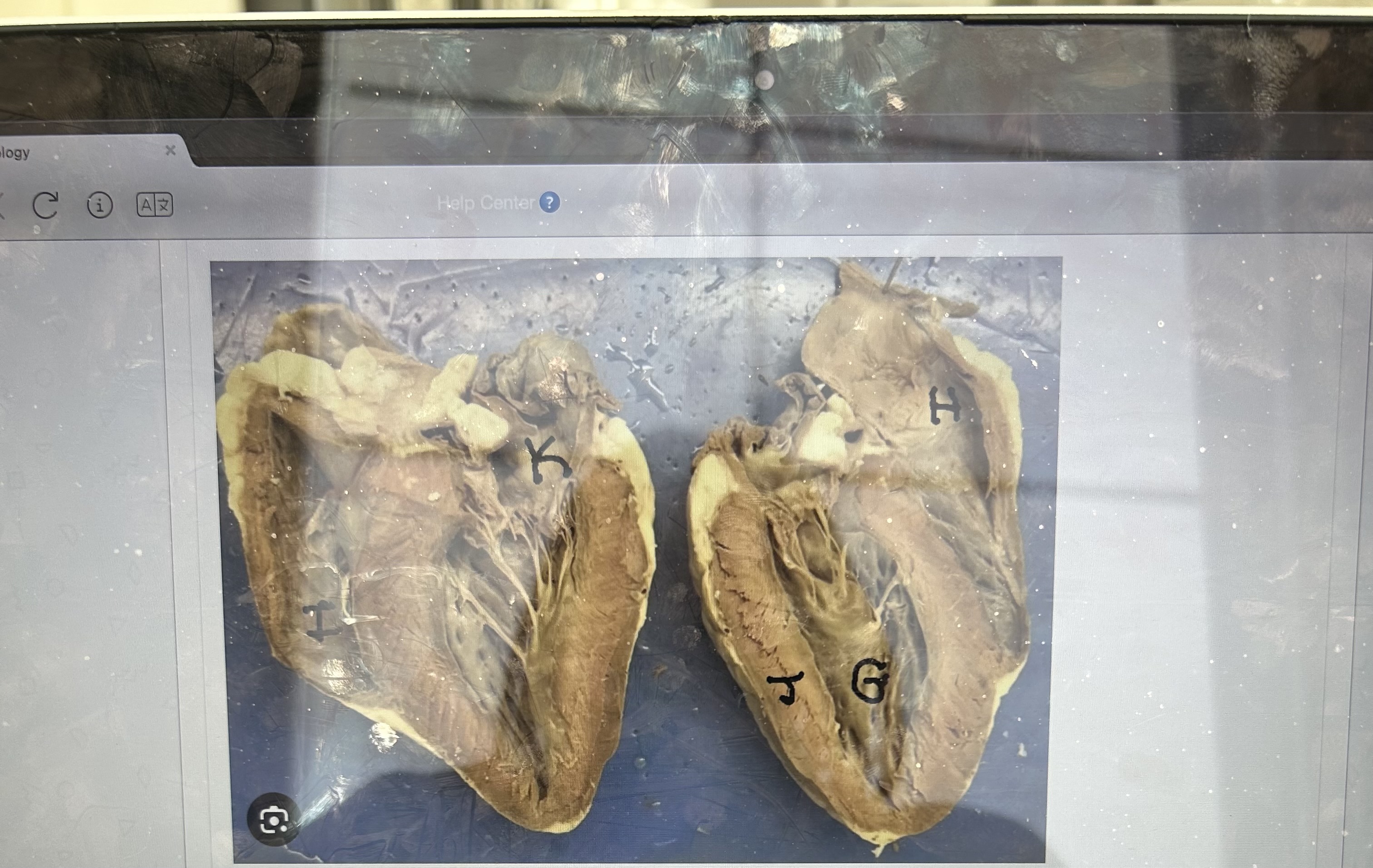 <p>What is G? </p><p>What is H?</p><p>What is I? </p><p>What is J?</p><p>• right ventricle </p><p>• left atrium </p><p>• left ventricle </p><p>• myocardium </p><p>• aorta </p><p>• pulmonary artery/trunk</p>