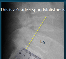 <p>Q what is the name of this measurement? and what is the average + range?</p>