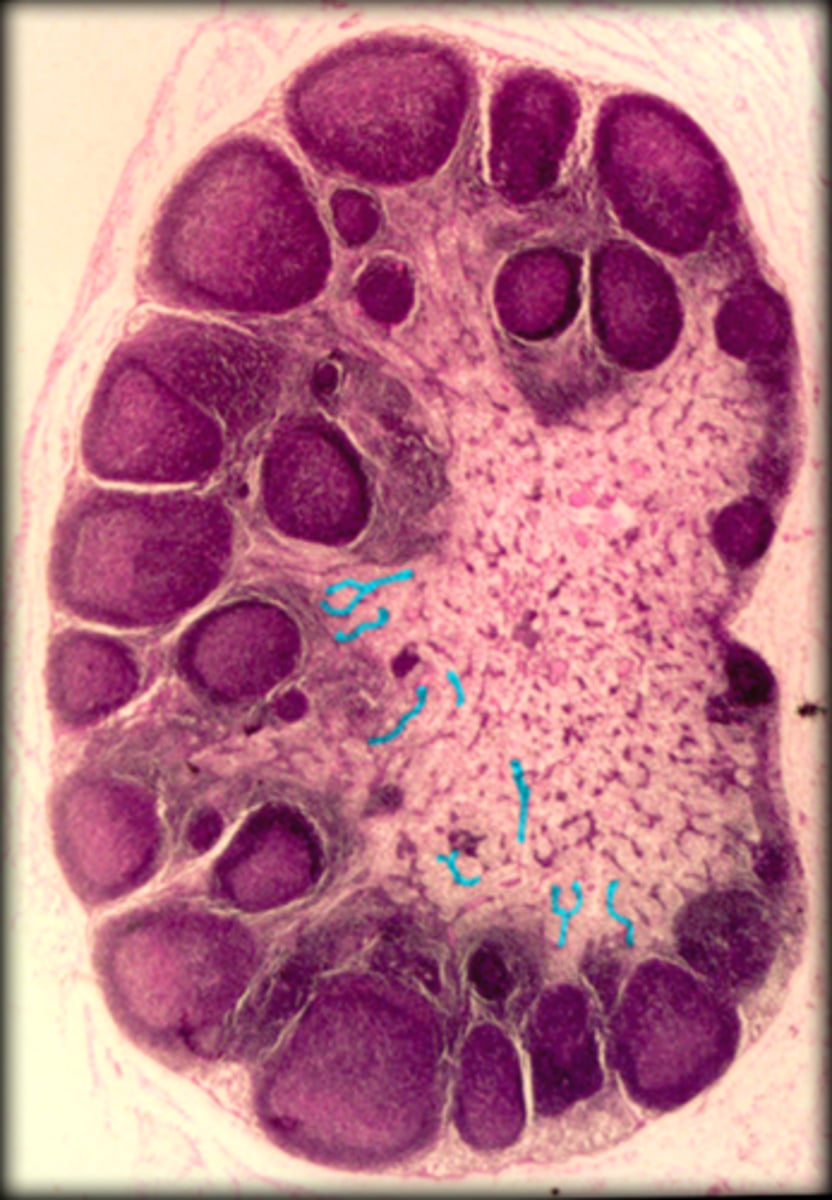 <p>Lymph node</p><p>-There are some T-lymphocytes and macrophages are collected here.</p>