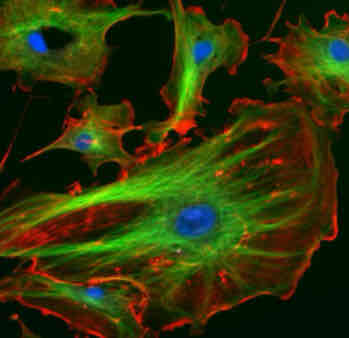 <p>Cytoskeleton</p>