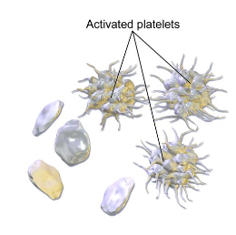 <p>-removal/treatment of tumor</p><p>-immunosuppression if IMTP</p>