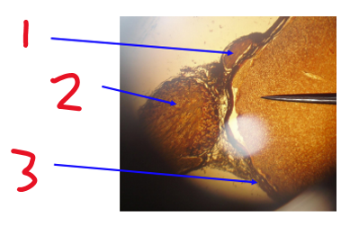 <p>Name structure 2</p>
