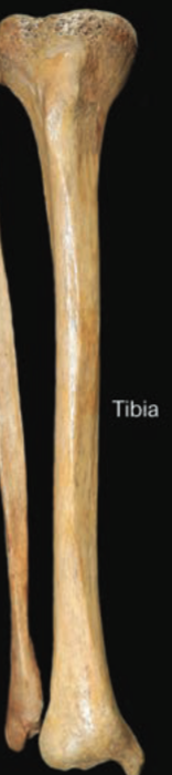 <p>Tibia</p>