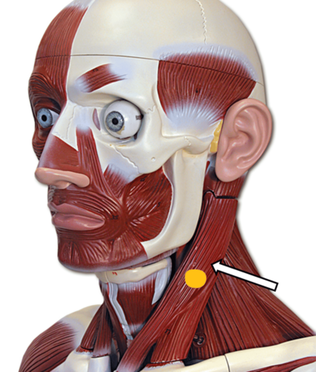 <p>name the muscle</p>