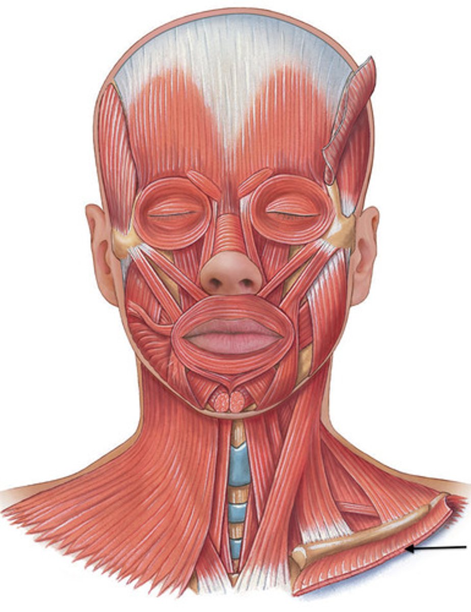 <p>What muscle is this?</p>