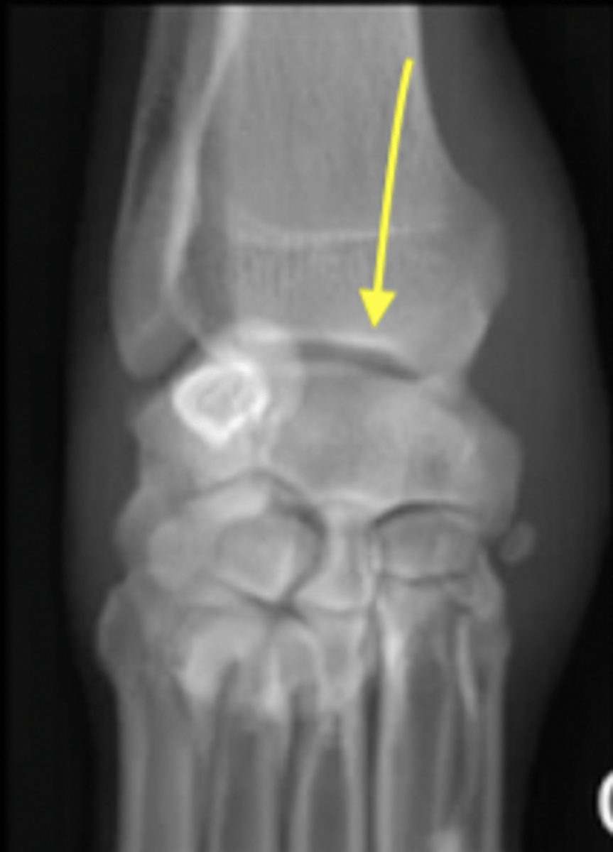 <p>What type of joint is pictured?</p>