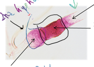 <p>zygospore</p>