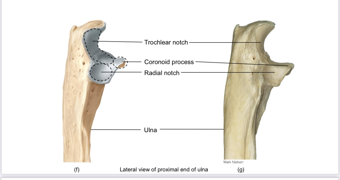 <p>Ulna: radial notch</p>