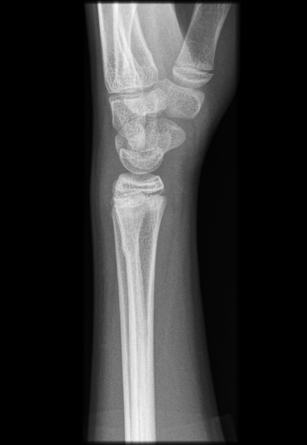 <p>Describe the abnormality demonstrated.</p>