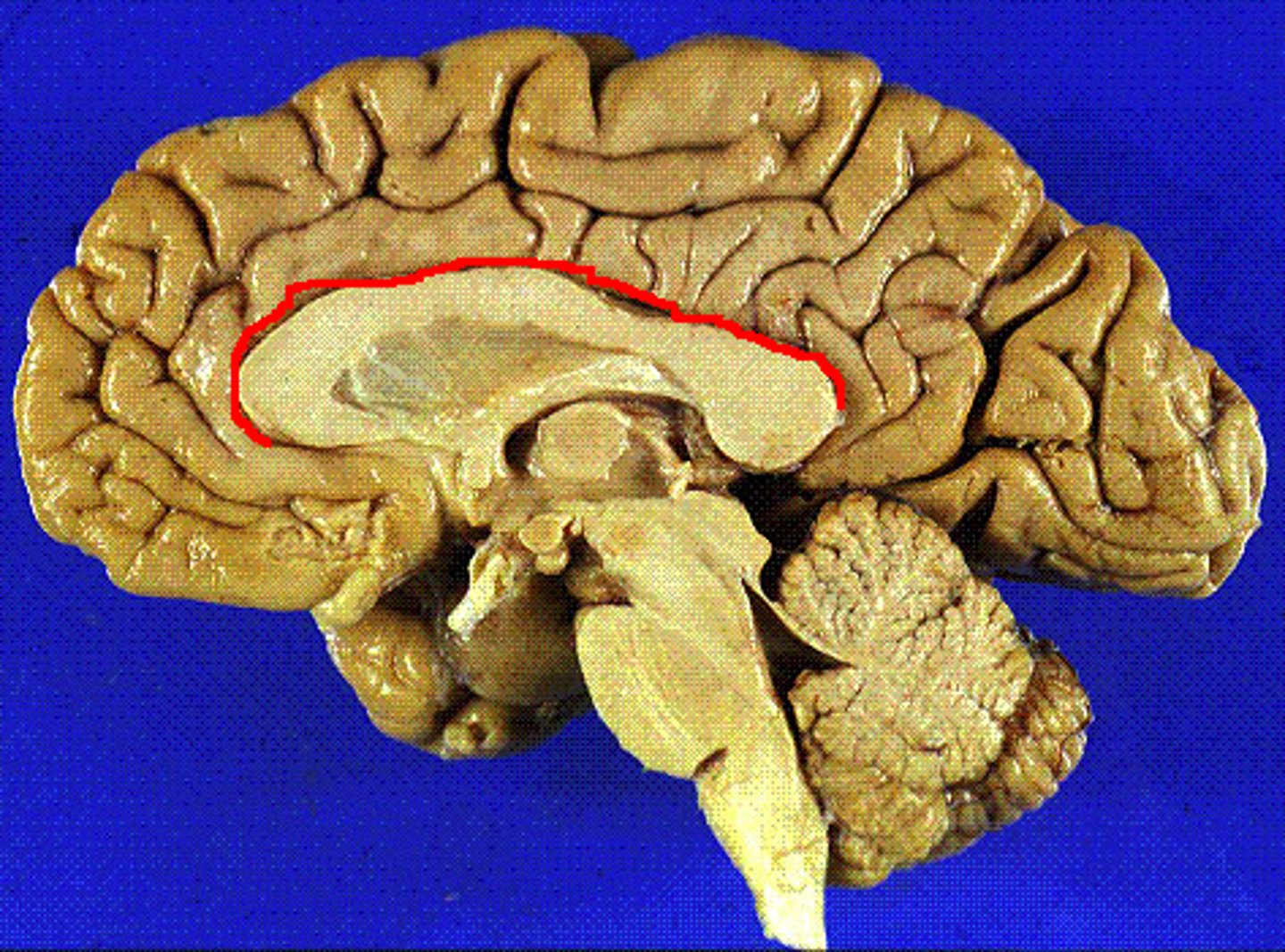 <p>Separates cingulate gyrus from corpus callosum</p>