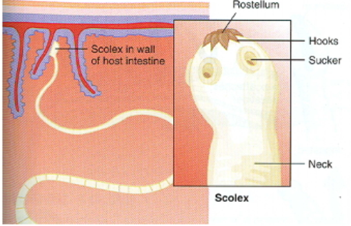 <p>Platyhelminthes: Cestoidea Body Structure </p>