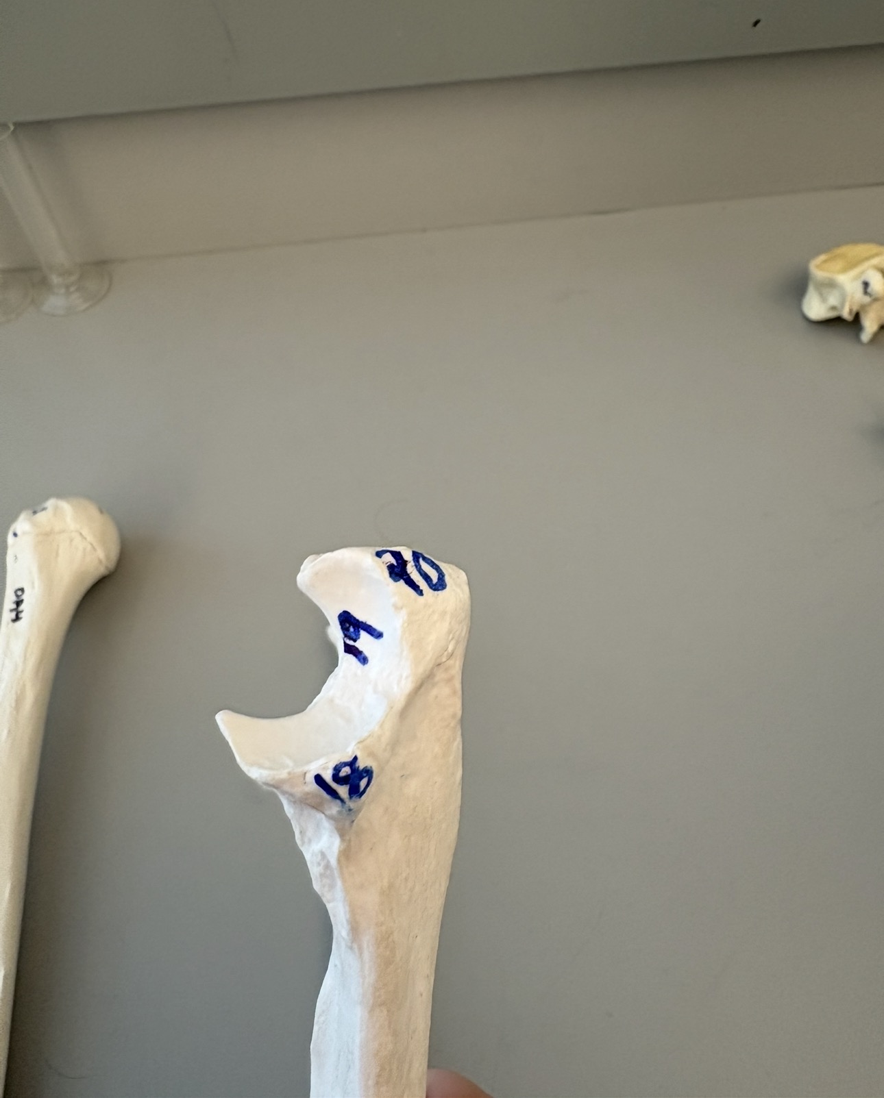<p>what is 20 of the ulna?</p>