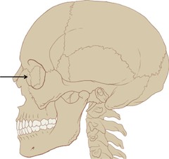 Name this bone.