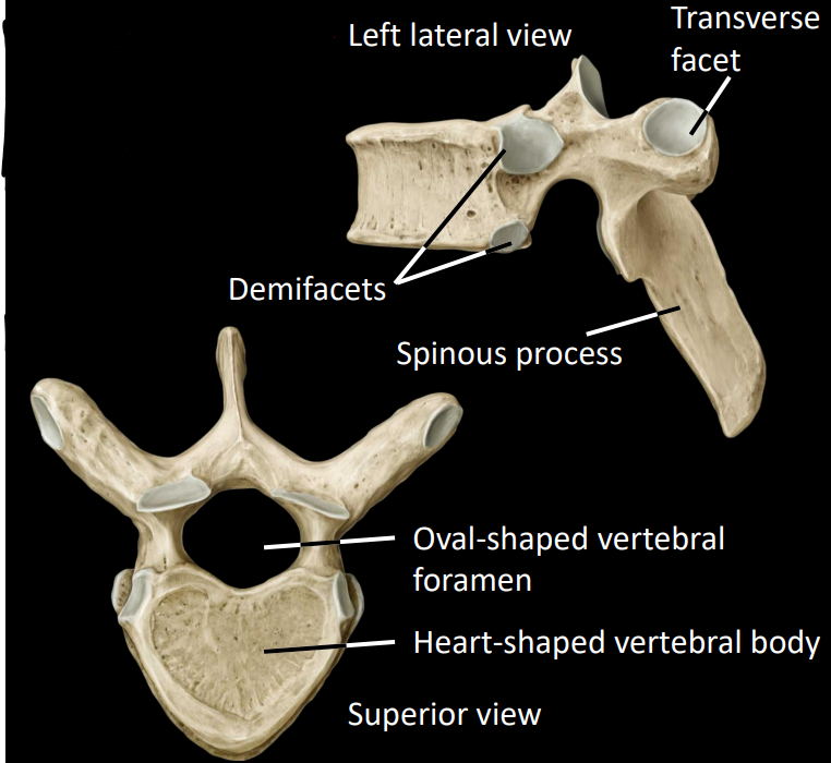 <p><strong><u>Articulation with ribs:</u></strong></p><ul><li><p>demifacets</p></li><li><p>transverse facet</p></li><li><p>elongated spinous processes</p></li><li><p>small, heart-shaped bodies</p></li></ul><p></p>