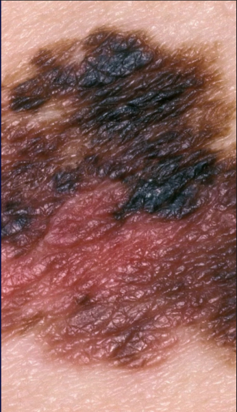 term image
