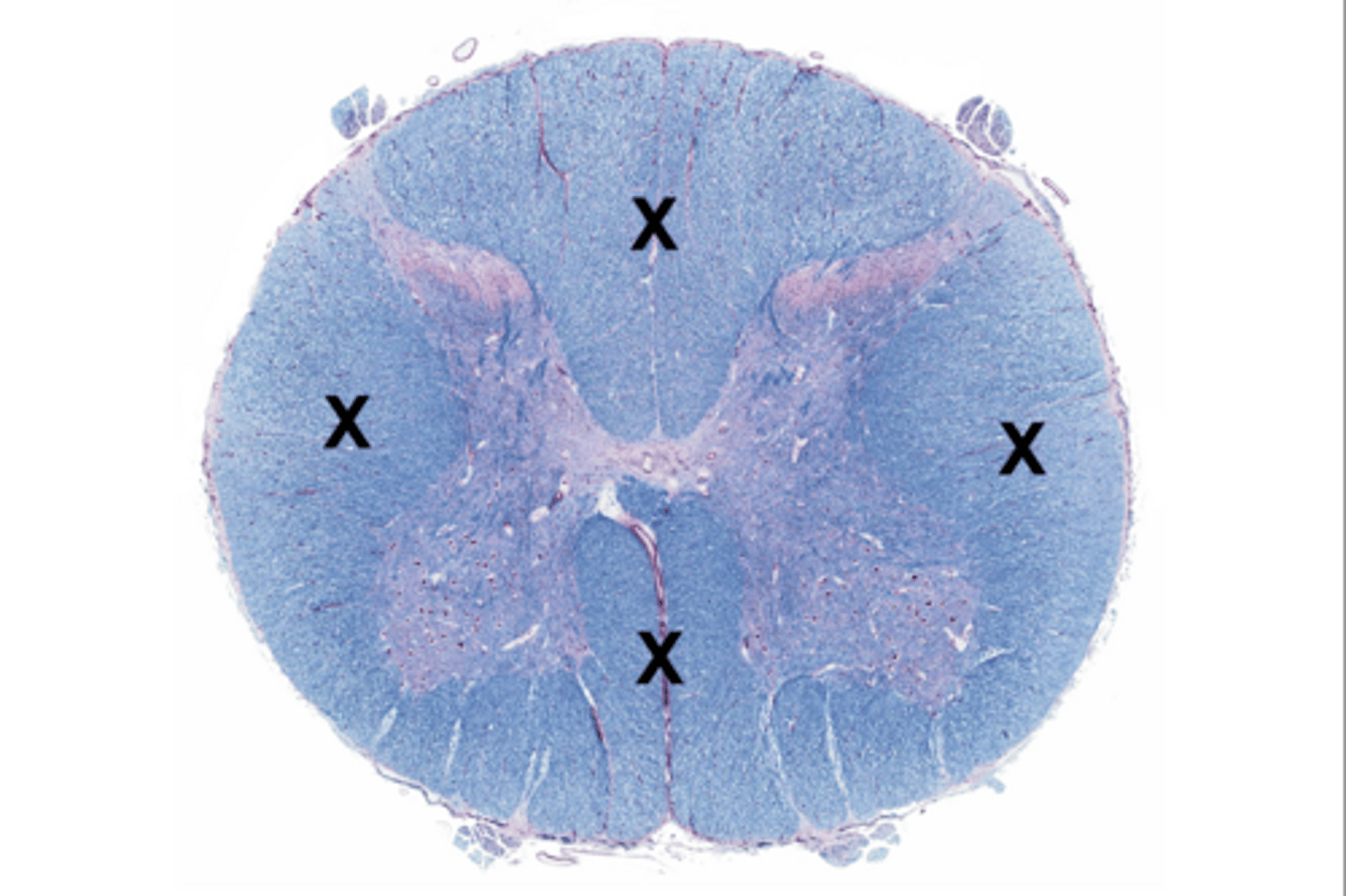 <p>Whitish nervous tissue of the CNS consisting of neurons and their myelin sheaths.</p>