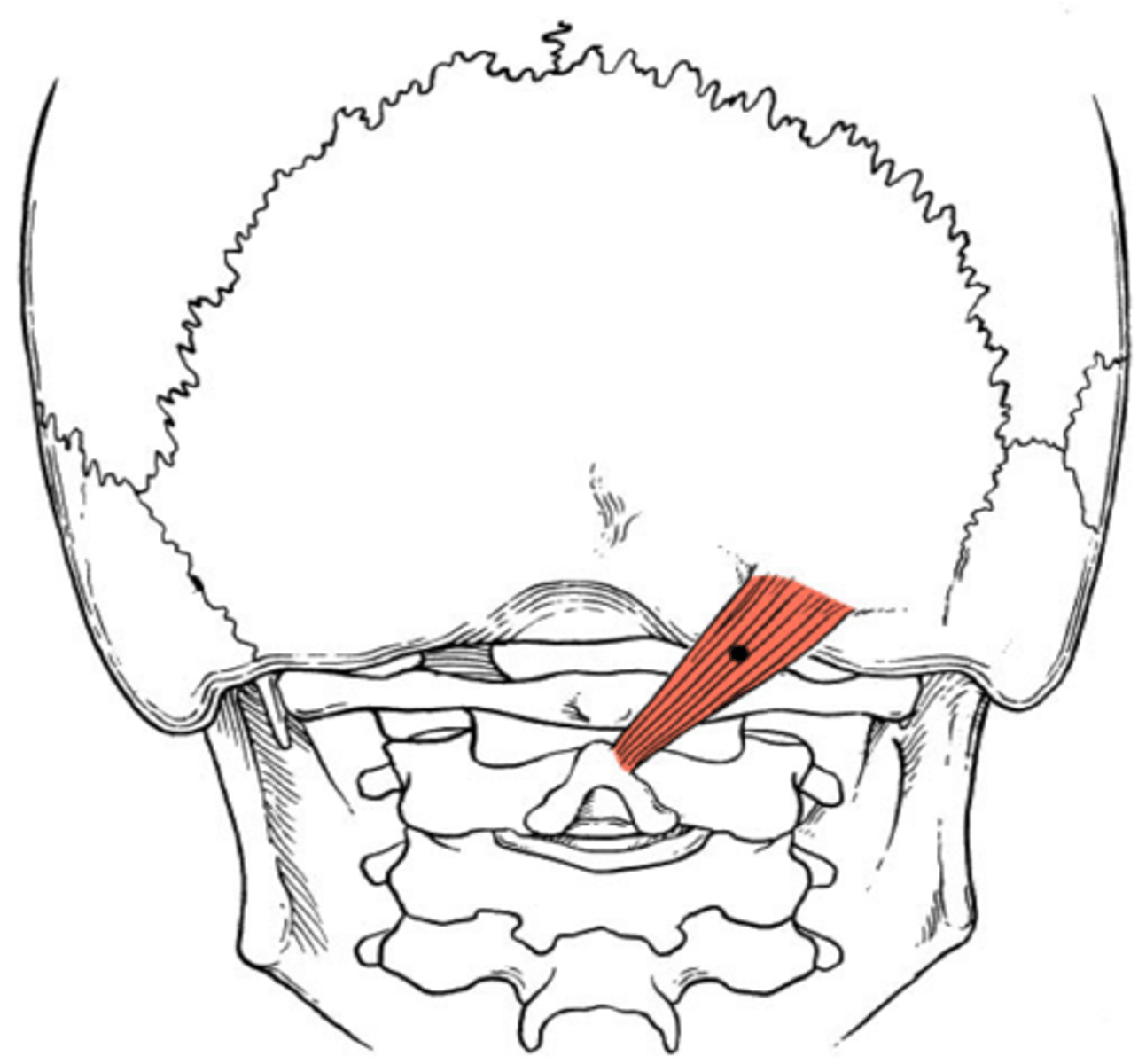 <p>inferior nuchal line (occipital)</p>