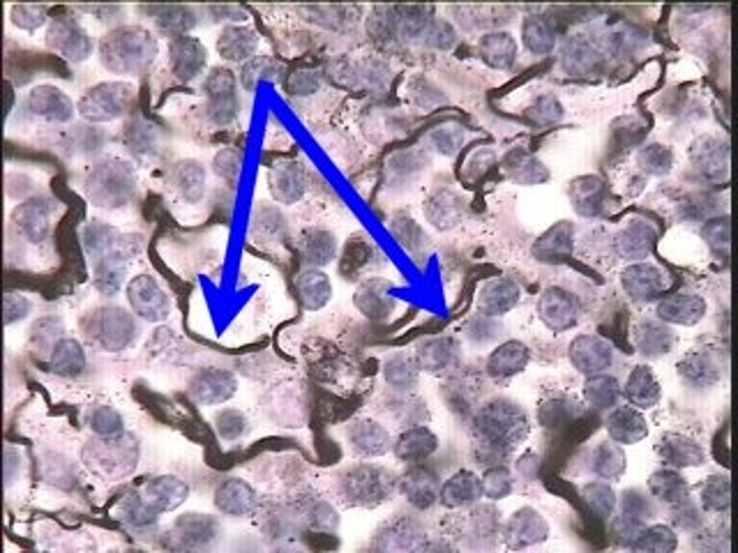 <p>Thin, branching collagen-like; in lymphatic organs</p>