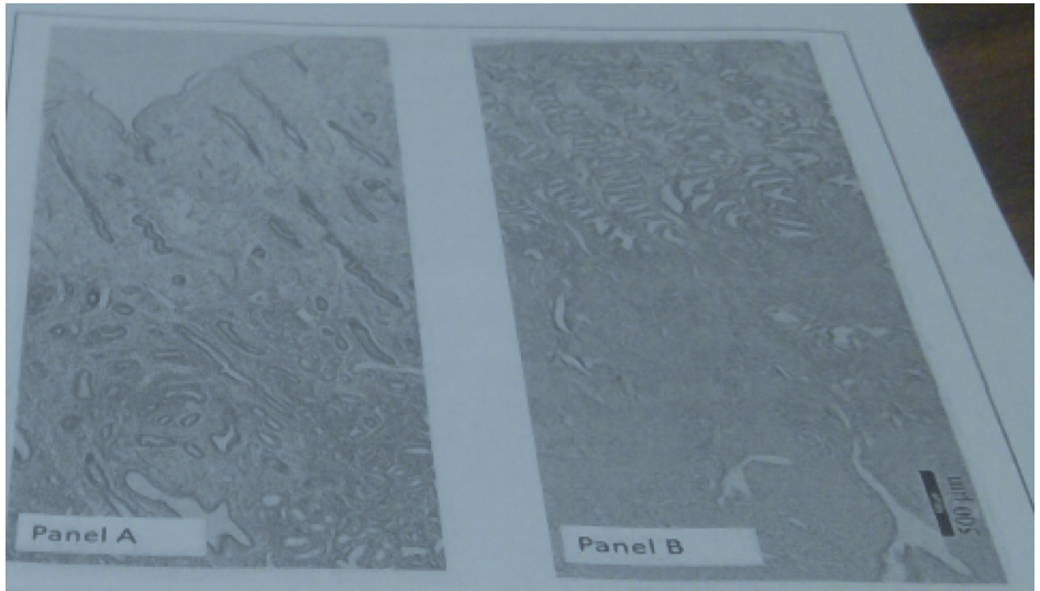 22\. Shown in the attached light micrographs are two phases of the endometrium. The phase shown in panel A is regulated by