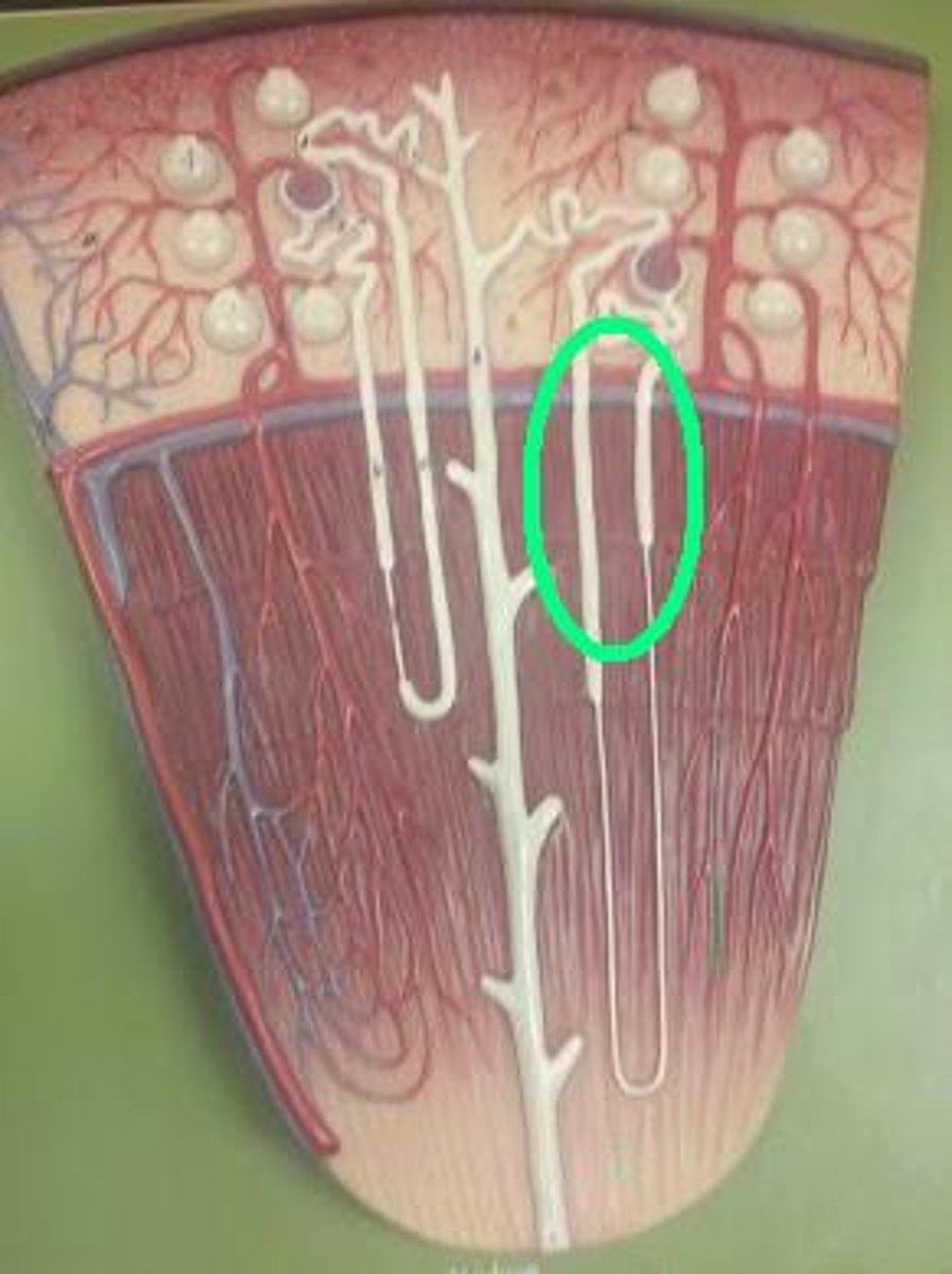 <p>-simple cuboidal epithelium</p><p>-found primarily in ascending limb.</p><p>-Has highly effective pumping mechanism</p><p>-2/3 of Na+ and Cl- are pumped out of tubular fluid before it reaching DCT (solute concentration in tubular fluid declines)</p>