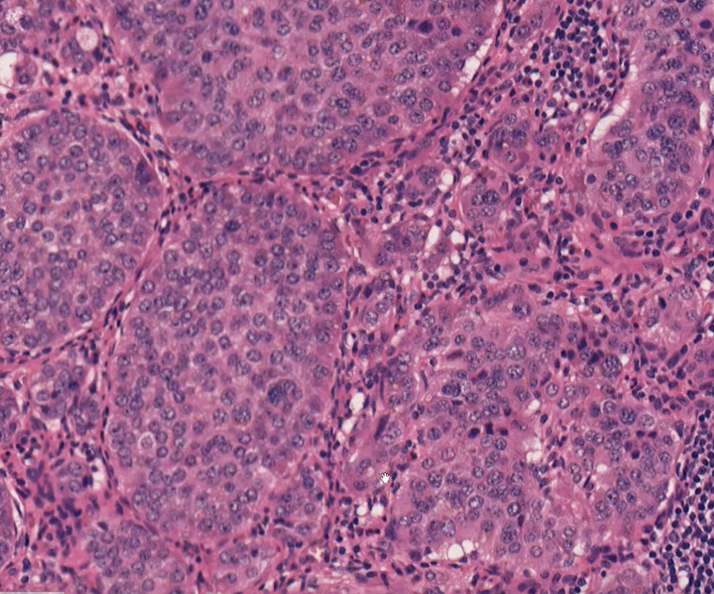 term image