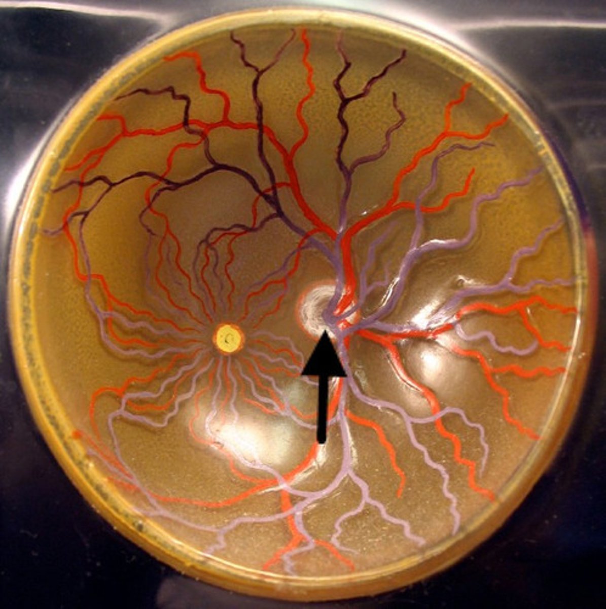 <p>Region at the back of the eye where the optic nerve meets the retina. No photoreceptors are here</p>