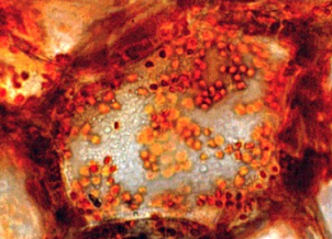 <p>Chromoplasts</p>