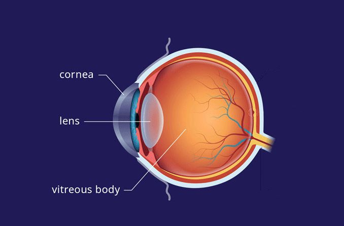 <p>in the posterior chamber between the vitreous and iris</p>
