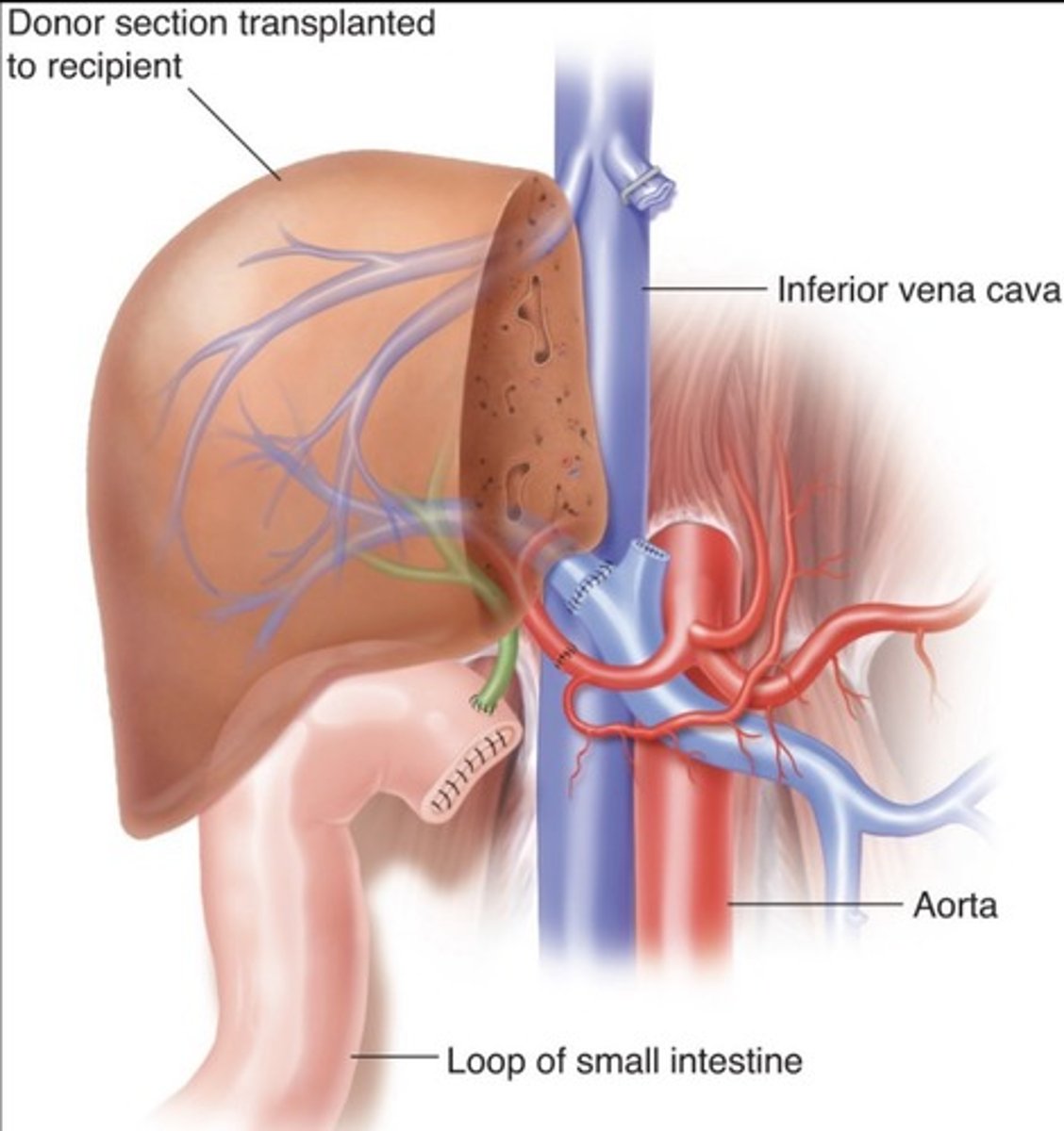 <p>Right lobe for adults</p><p>Left lobe for children</p>