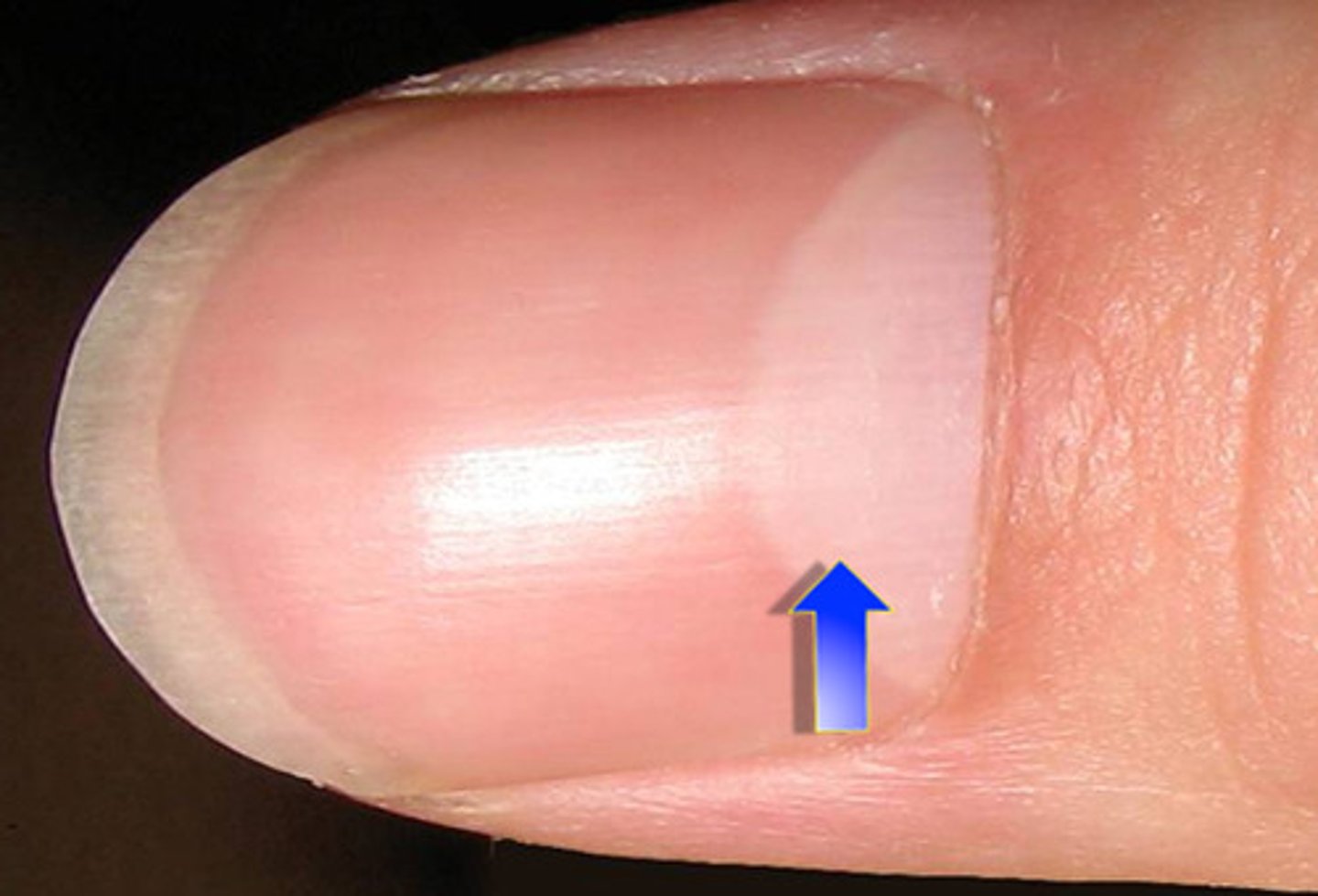 <p>fingernail</p>