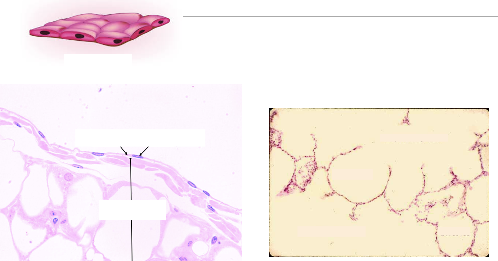 <p>What type of epithelial tissue?</p>