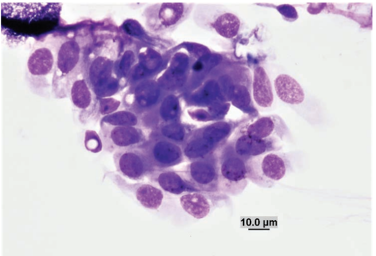 <p>Guinea pig conjunctival scraping</p><img src="https://knowt-user-attachments.s3.amazonaws.com/3b8854d5-7a3f-416f-bce2-7a5b20854e5b.png" data-width="100%" data-align="center" alt="knowt flashcard image"><p></p>