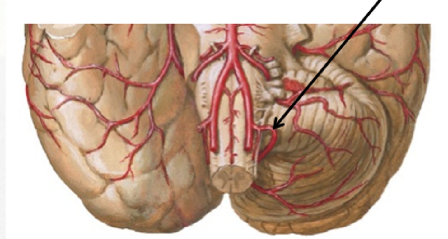 <p>from vertebral artery; supplies the posteroinferior cerebellum</p>