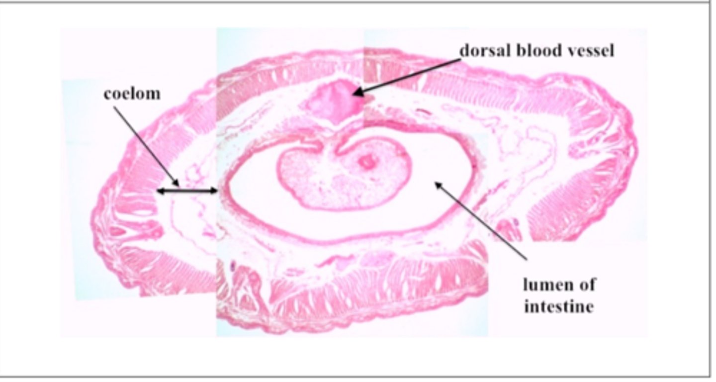 <p>earth worm cross section</p>